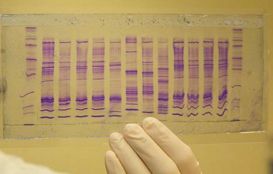 Tumori, diagnosi precoce (e veloce) grazie alla saliva