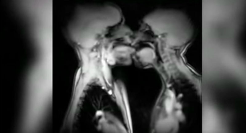 Sesso ai raggi X: orgasmo di coppia dentro una macchina per la risonanza
