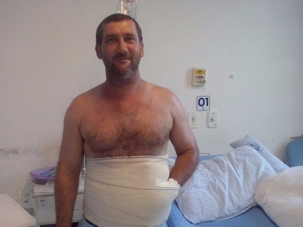 Viene operato, si risveglia con la mano dietro la pancia