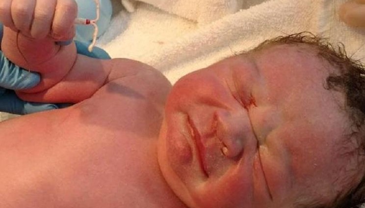 Usa, bimbo nasce tenendo in mano la spirale della mamma